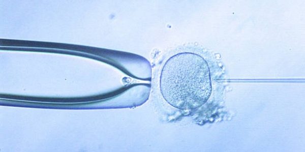 Is IVF More Affordable in Rajasthan Than Other States?