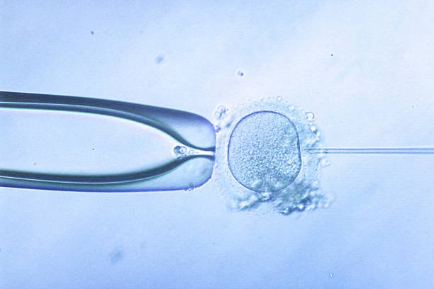 Is IVF More Affordable in Rajasthan Than Other States?